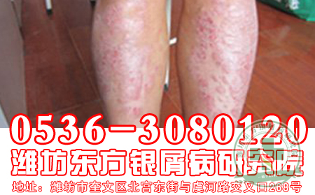 治疗过度  适得其反