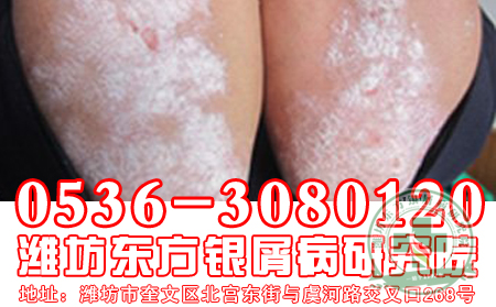 小赵的婚事